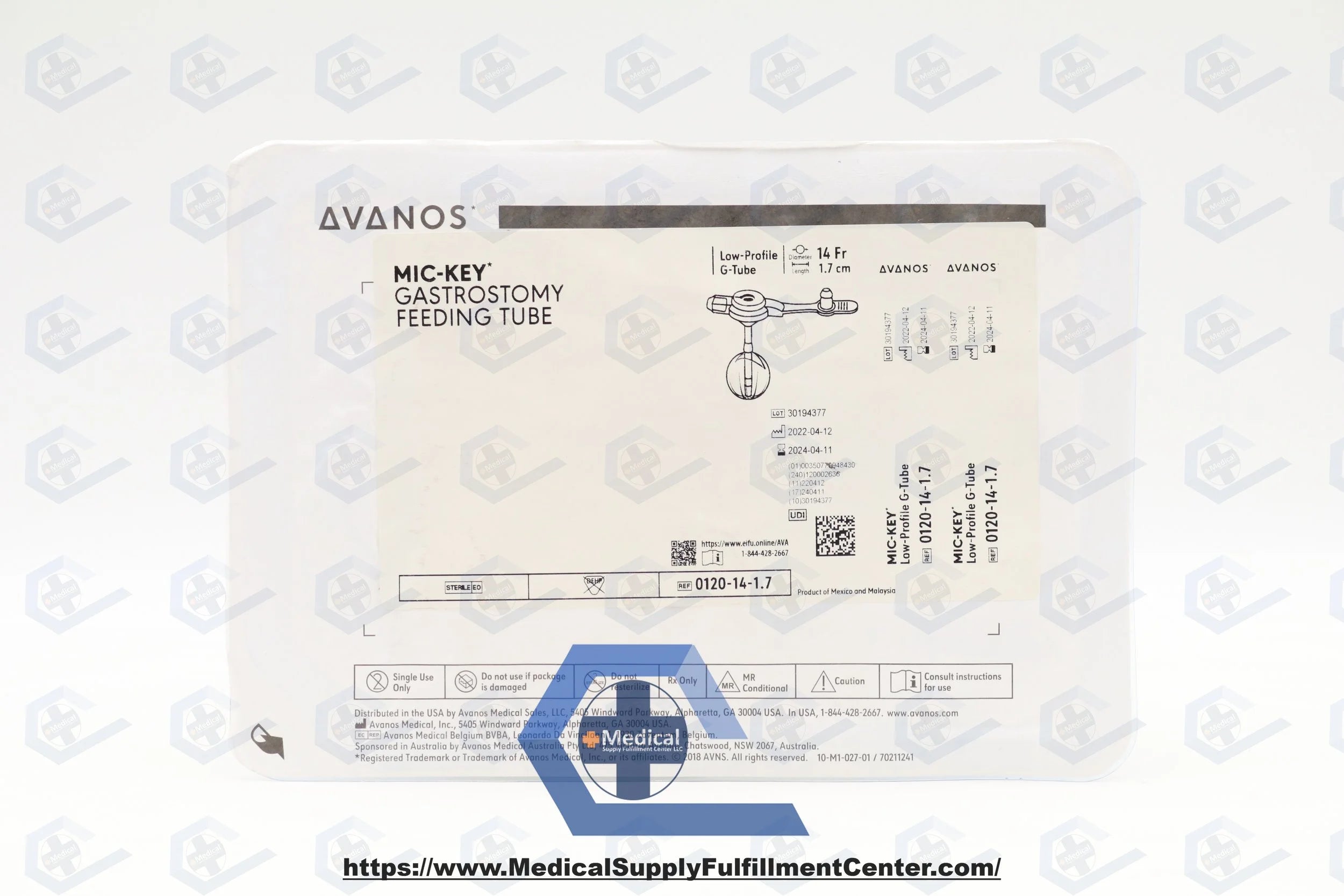 Avanos Medical | 0120-14-1.7 | MIC-KEY Low-Profile Gastrostomy Feeding Tube: 14F x 1.7cm