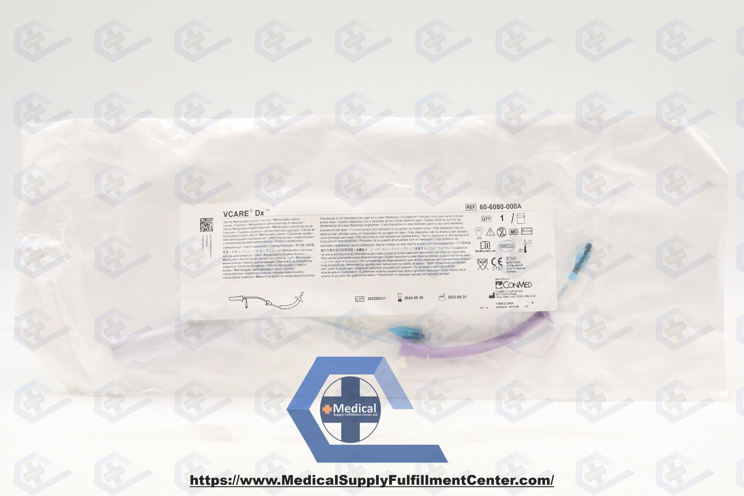 Conmed | 60-6080-000A | Uterine Manipulator, Provides Superior Exposure and Access to Pelvic Cavity